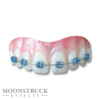 Lemmy-teeth-braces-blue